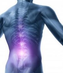 back pain